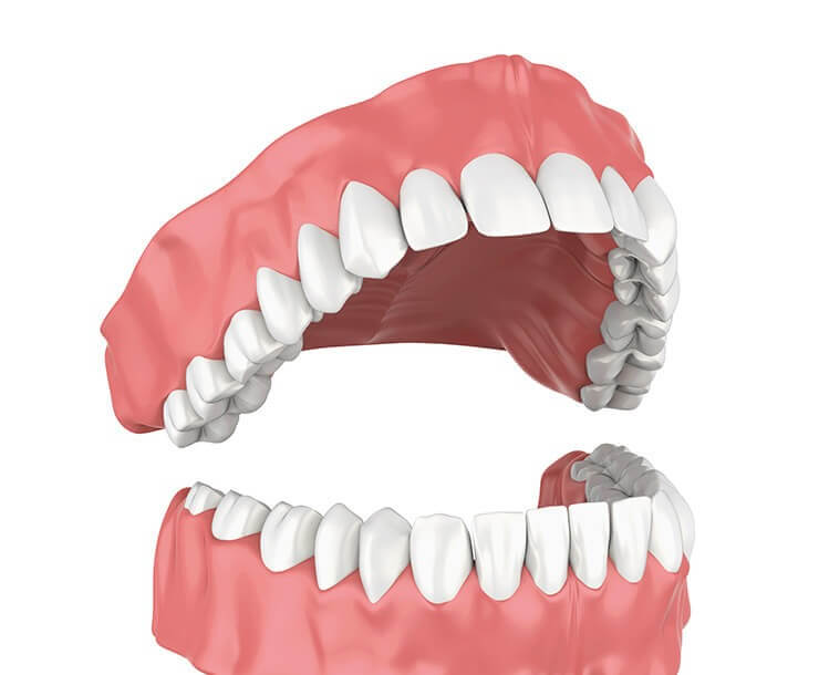 illustration of a set of dentures