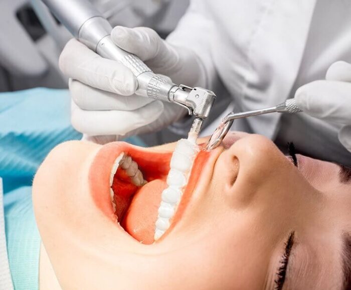Amalgam & Composite Fillings Difference Seastone Dental