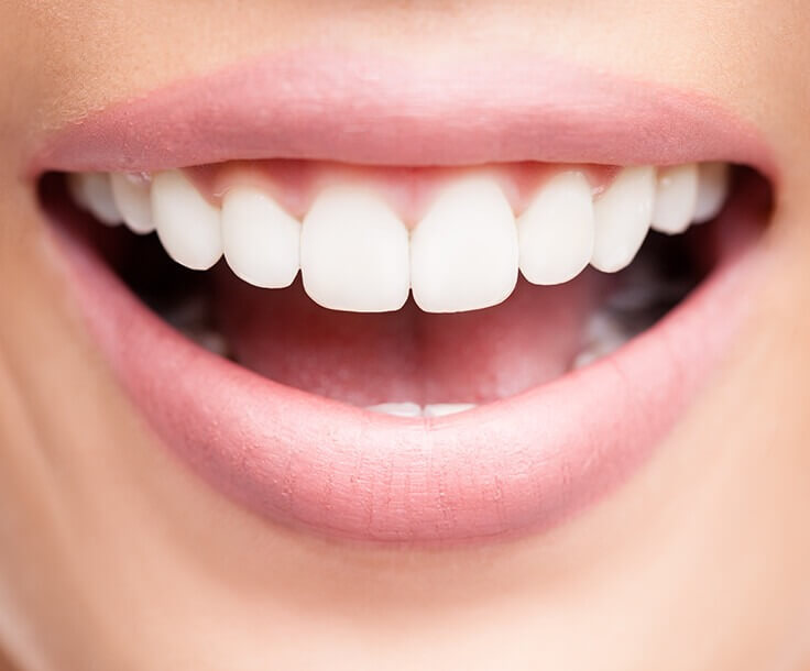 closeup of a bright, white smile