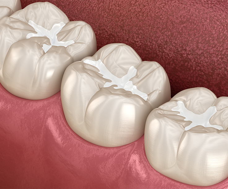 illustration of molars