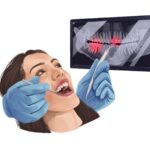 woman at dentist for loose dental filling or dental crown
